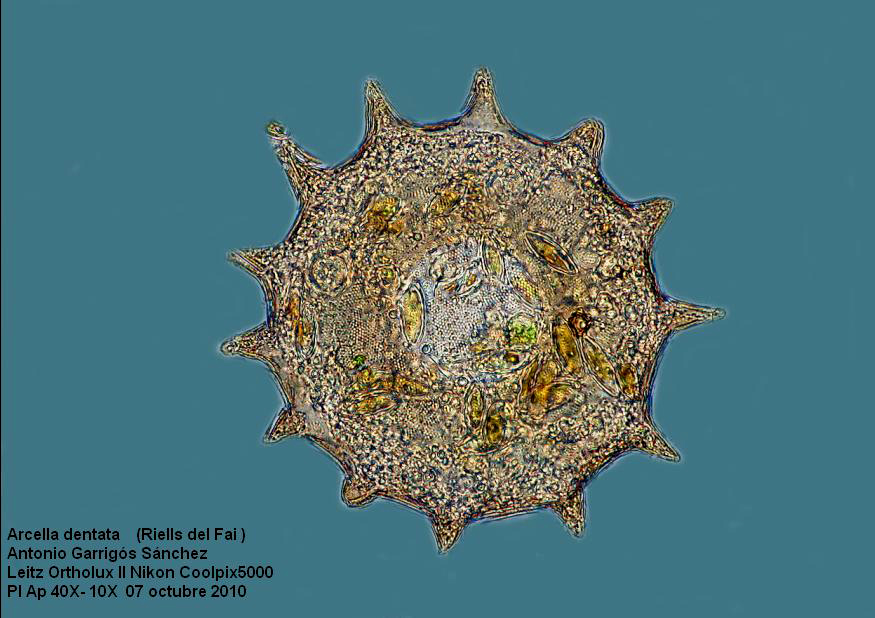 Arcella dentata